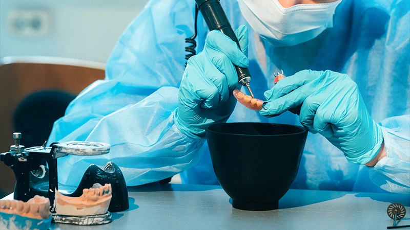 cosmetic dentistry workflow